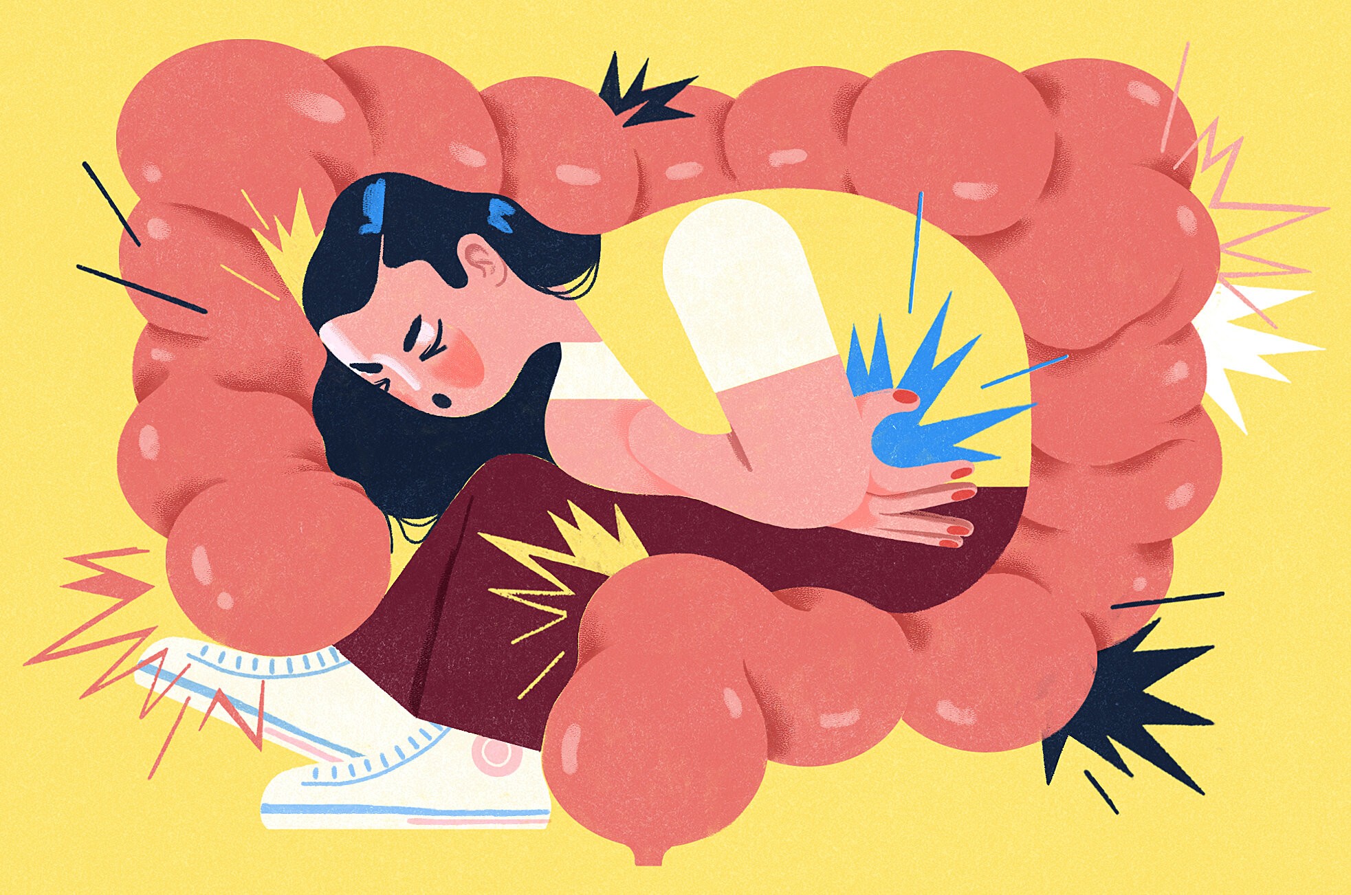 علائم سندروم روده تحریک پذیر در زنان